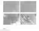 Fig. 03 - METHOD FOR PRODUCING AUTONOMOUSLY CONTRACTING CARDIAC MUSCLE CELLS FROM ADULT STEM CELLS, IN PARTICULAR HUMAN ADULT STEM CELLS