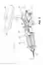 Fig. 03 - Medical devices having releasable coupling