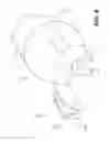 Fig. 10 - Medical devices having releasable coupling