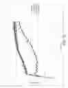 Fig. 03 - Inflatable retention system for enteral feeding device