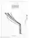 Fig. 06 - Inflatable retention system for enteral feeding device