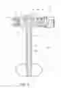Fig. 07 - Inflatable retention system for enteral feeding device