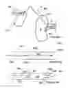 Fig. 04 - APPARATUSES FOR BILATERAL RENAL NEUROMODULATION