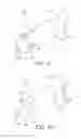 Fig. 09 - Indwelling needle and indwelling needle assembly