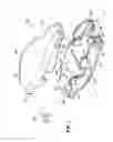 Fig. 02 - Universal catheter securement device
