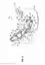 Fig. 03 - Universal catheter securement device