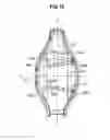 Fig. 11 - Universal catheter securement device