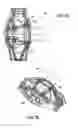 Fig. 13 - Universal catheter securement device