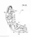 Fig. 16 - Universal catheter securement device