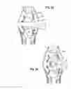 Fig. 18 - Universal catheter securement device