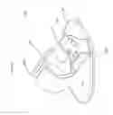 Fig. 52 - Universal catheter securement device