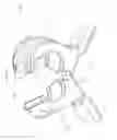 Fig. 59 - Universal catheter securement device