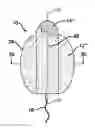 Fig. 01 - FLUID MANAGEMENT DEVICE WITH FLUID TRANSPORT ELEMENT FOR USE WITHIN A BODY