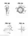Fig. 09 - FLUID MANAGEMENT DEVICE WITH FLUID TRANSPORT ELEMENT FOR USE WITHIN A BODY