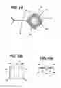 Fig. 12 - FLUID MANAGEMENT DEVICE WITH FLUID TRANSPORT ELEMENT FOR USE WITHIN A BODY