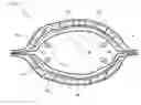 Fig. 04 - URINE ABSORBING ARTICLE