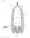 Fig. 08 - URINE ABSORBING ARTICLE