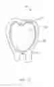 Fig. 05 - SACRAL WOUND DRESSING AND METHOD OF MANUFACTURING A WOUND THERAPY DEVICE