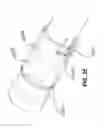 Fig. 21 - Methods and devices for autoflush syringes