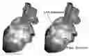 Fig. 01 - DELIVERY METHODS FOR A BIOLOGICAL PACEMAKER MINIMIZING SOURCE-SINK MISMATCH