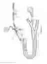 Fig. 03 - Catheter assembly and method