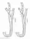 Fig. 05 - Catheter assembly and method