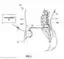 Fig. 02 - Medical pump with fixed stroke length