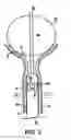 Fig. 05 - Apparatus and methods for treating female urinary incontinence