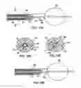 Fig. 12 - Apparatus and methods for treating female urinary incontinence