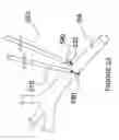 Fig. 20 - APPARATUSES FOR RENAL NEUROMODULATION
