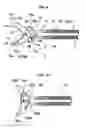 Fig. 06 - Scissors for endoscope