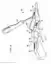 Fig. 08 - Intramedullary fixation assembly and method of use