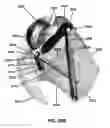 Fig. 27 - Intramedullary fixation assembly and method of use