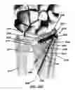 Fig. 28 - Intramedullary fixation assembly and method of use