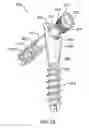 Fig. 37 - Intramedullary fixation assembly and method of use