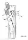 Fig. 07 - Lockable intramedullary fixation device