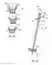 Fig. 14 - Lockable intramedullary fixation device