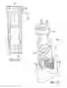 Fig. 19 - Lockable intramedullary fixation device
