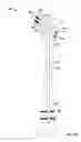 Fig. 24 - Lockable intramedullary fixation device