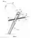 Fig. 27 - Lockable intramedullary fixation device