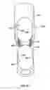 Fig. 32 - Lockable intramedullary fixation device