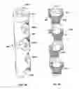 Fig. 37 - Lockable intramedullary fixation device