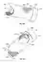Fig. 43 - Lockable intramedullary fixation device