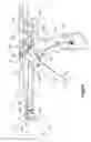 Fig. 11 - Bone fixation assembly