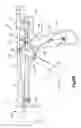 Fig. 12 - Bone fixation assembly