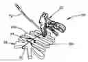 Fig. 01 - Bone fixation assembly