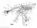 Fig. 17 - Bone fixation assembly