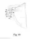 Fig. 09 - Oscillating rasp for use in an orthopaedic surgical procedure
