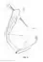 Fig. 04 - Surgical aiming device