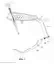 Fig. 06 - Surgical aiming device